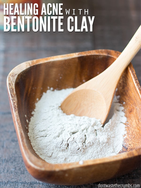 I've switched to an all natural skincare routine, which has allowed me to heal acne with bentonite clay. Here's how I use it, and how it's made a world of a difference in my skin! :: DontWastetheCrumbs.com