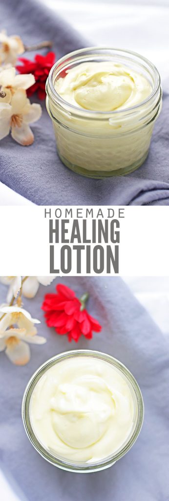 DIY Homemade Healing Lotion